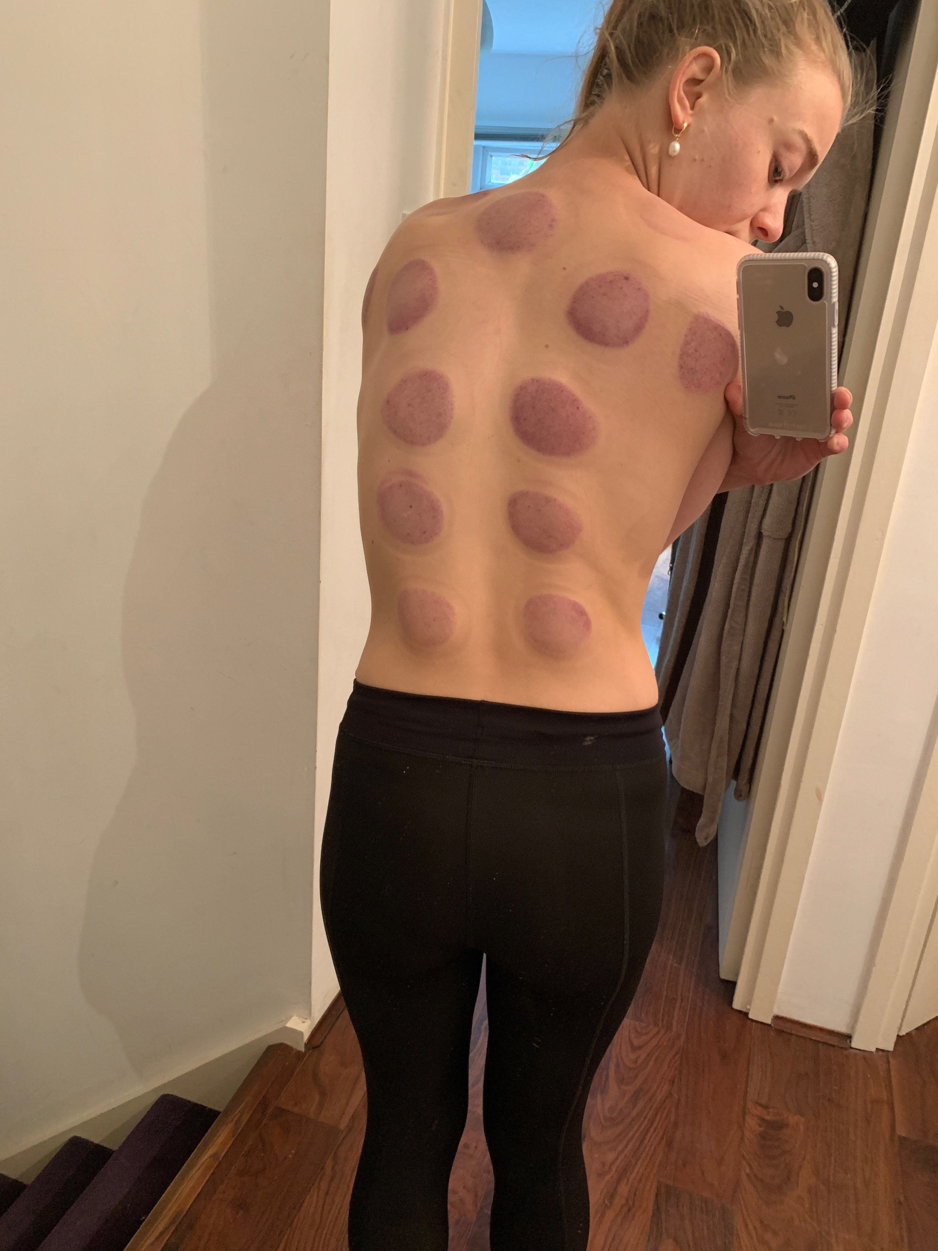 Cupping-Becky-Hill-Interview